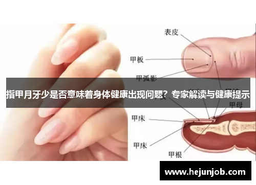 指甲月牙少是否意味着身体健康出现问题?专家解读与健康提示